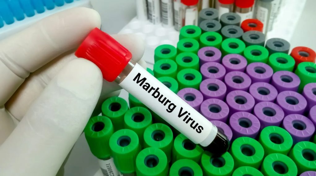 Virus de Marburgo: la enfermedad mortal que preocupa a los expertos en salud